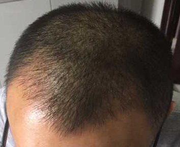 发际线分享社区