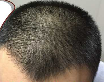 发际线分享社区