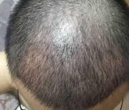 发际线分享社区