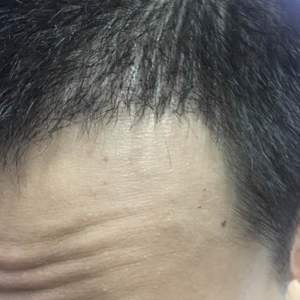 发际线分享社区