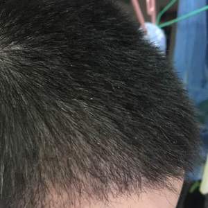 发际线分享社区