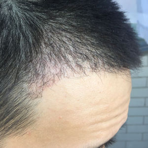 发际线分享社区