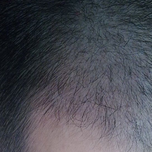 发际线分享社区