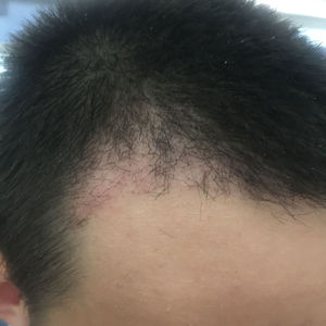 发际线分享社区