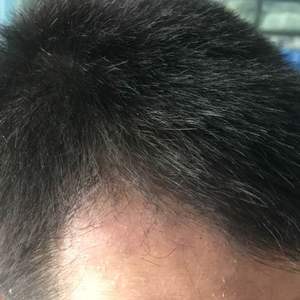 发际线分享社区