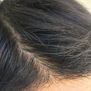 发际线分享社区