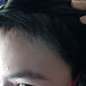 发际线分享社区