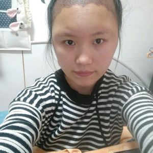 发际线分享社区