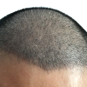 发际线分享社区