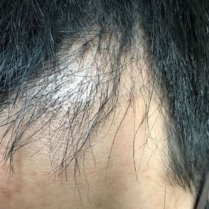 发际线分享社区