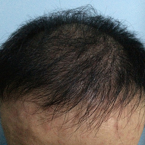 发际线分享社区