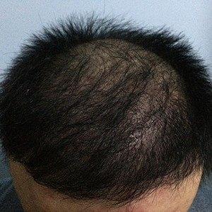 发际线分享社区
