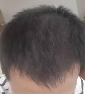 发际线分享社区