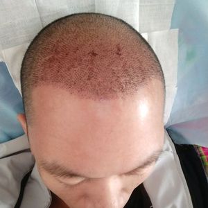 发际线分享社区