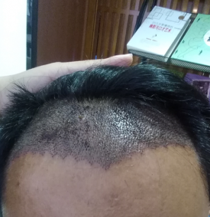 发际线分享社区