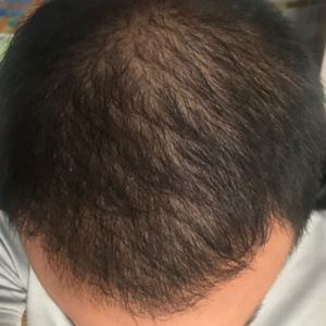 发际线分享社区