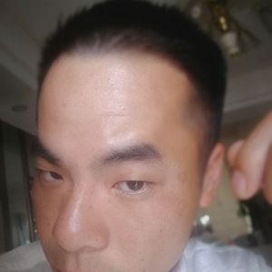 发际线分享社区