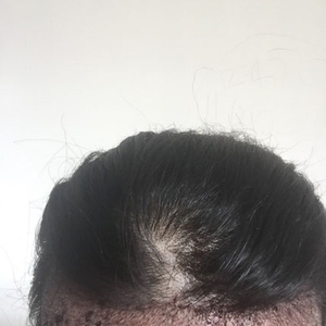 发际线分享社区