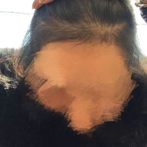 发际线分享社区