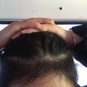 发际线分享社区