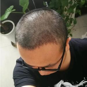 发际线分享社区