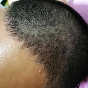 发际线分享社区