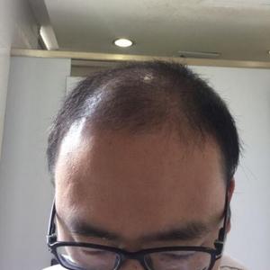 发际线分享社区