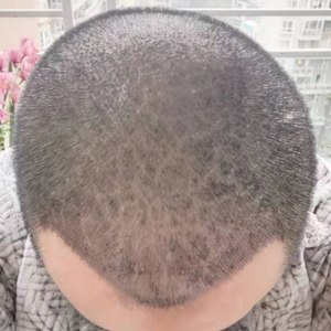 发际线分享社区