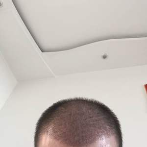 发际线分享社区