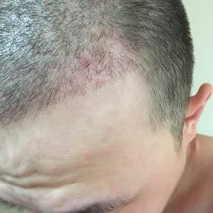 发际线分享社区