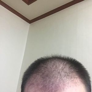 发际线分享社区