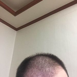 发际线分享社区