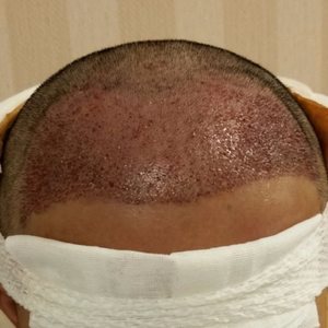 发际线分享社区