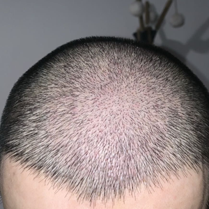 发际线分享社区