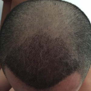 发际线分享社区