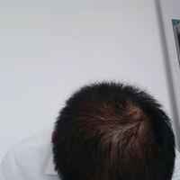 <font color="red">稀少加密</font>用戶圖片
