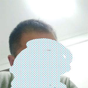 发际线分享社区