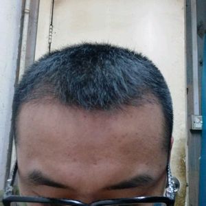 发际线分享社区
