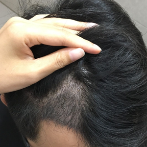 发际线分享社区