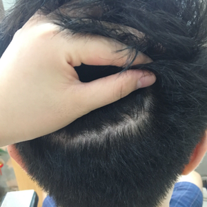 发际线分享社区