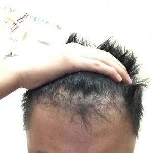 发际线分享社区