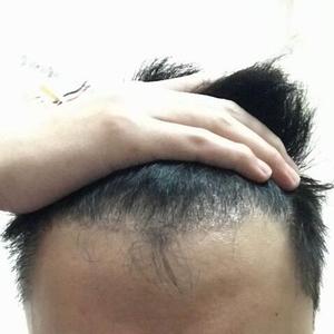 发际线分享社区
