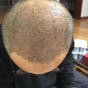 发际线分享社区
