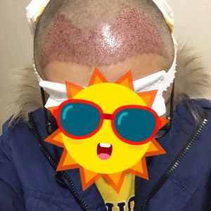发际线分享社区