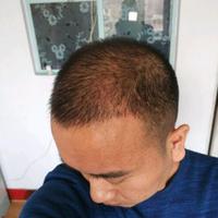 <font color="red">稀少加密</font>用戶圖片