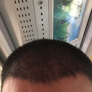 发际线分享社区