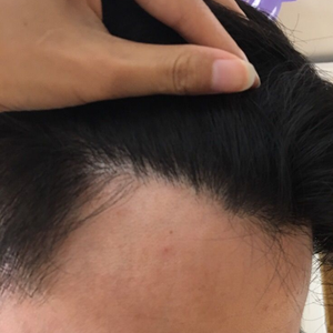 发际线分享社区