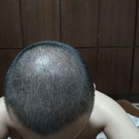 <font color="red">稀少加密</font>用戶圖片