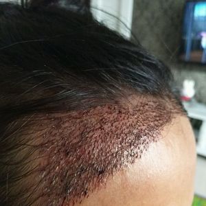 发际线分享社区