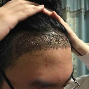 发际线分享社区